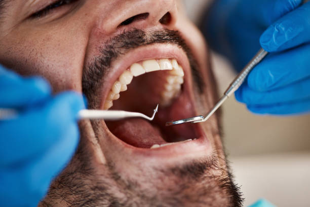 Best Emergency Orthodontic Repairs in Jamestown West, NY