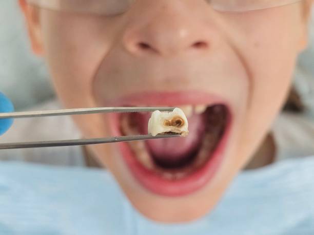 Best Walk-In Emergency Dentist in Jamestown West, NY